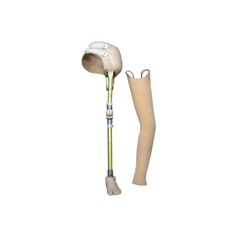 Dubens dalies protezas